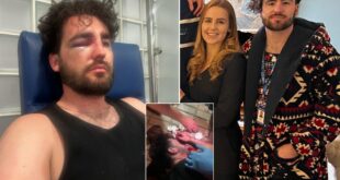 Exclusive: British groom-to-be needs facial reconstruction surgery after suffering 'brutal attack by nightclub bouncers' in Spain