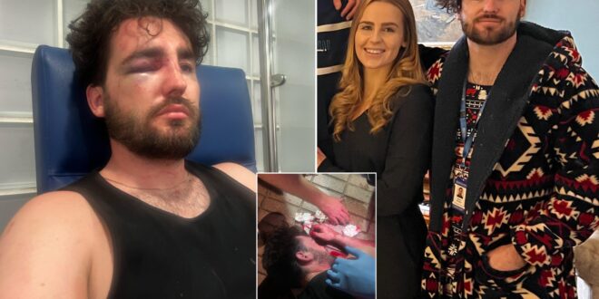 Exclusive: British groom-to-be needs facial reconstruction surgery after suffering 'brutal attack by nightclub bouncers' in Spain