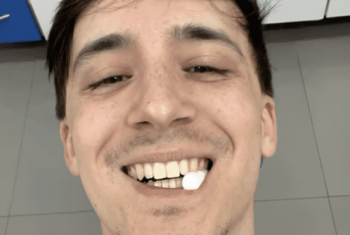 Watch: Spaniard living in the US flies to Barcelona for dental treatment and saves THOUSANDS in medical bills - CSN News