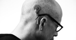 WHO reveals shocking hearing loss statistics - CSN News