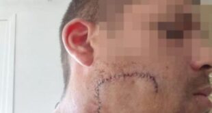 British tourist wanted in Spain for ‘slashing Mallorca bouncer’s face with a bottle’ is arrested