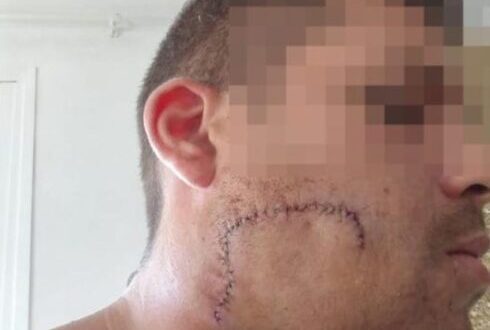 British tourist wanted in Spain for ‘slashing Mallorca bouncer’s face with a bottle’ is arrested