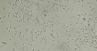 Danish male study links sperm quality to lifespan - CSN News