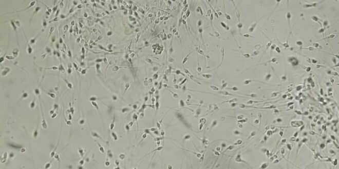 Danish male study links sperm quality to lifespan - CSN News