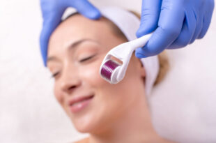 Microneedling Explained: Is It Worth It?