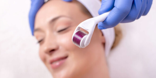 Microneedling Explained: Is It Worth It?