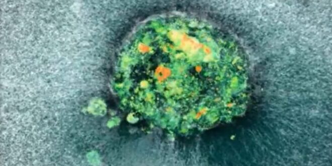 First-ever human embryo implantation filmed – and it could change IVF