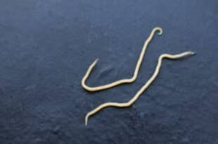 Why are so many people doing parasite cleanses? Experts weigh in on the latest health trend