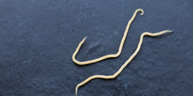 Why are so many people doing parasite cleanses? Experts weigh in on the latest health trend