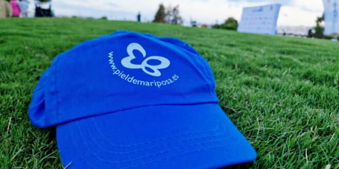 Fragile wings, strong community at Aloha golf