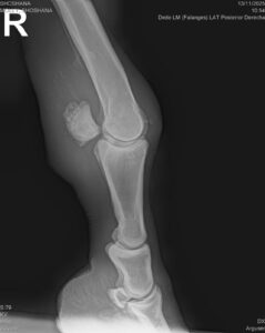 The x-ray of Shoshana's leg.