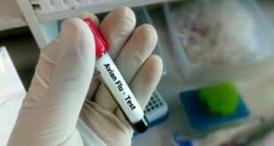 Asymptomatic H5N1 infections confirmed in global review as Spain boosts monitoring