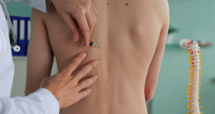 Ozone Therapy: A new hope for chronic pain sufferers in Spain