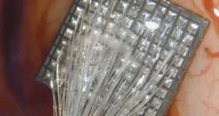 Brilliant breakthrough as Spanish scientists successfully restore vision to blind man using new brain implant