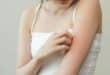 Scabies outbreak in Spain: What is driving the massive surge in cases?